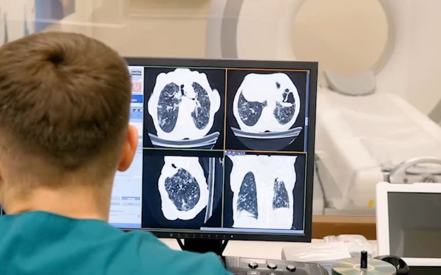 4DMedical wins contract to supply lung imaging technology to US radiology company