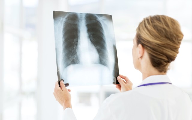 Amplia Therapeutics receives second orphan drug designation for treatment of chronic lung disease