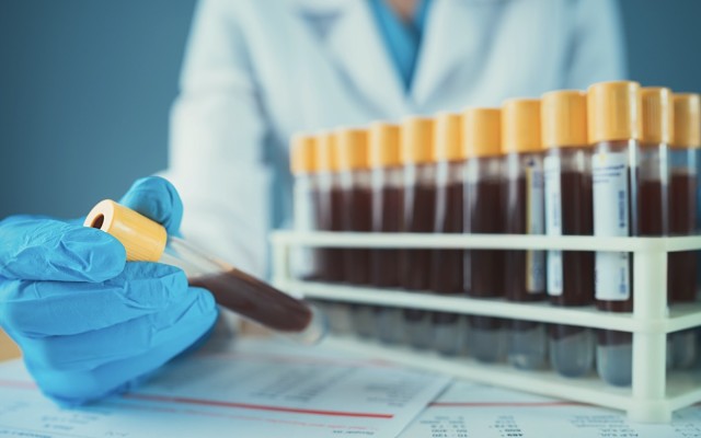 Biotron’s BIT225 drug show to enhance body’s immune response to HIV