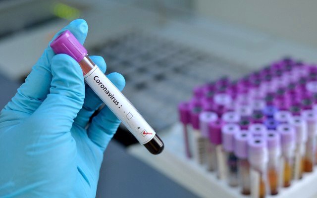 Biotron to commence testing of compounds to destroy coronavirus