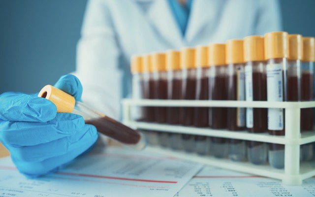 Biotron presents further phase 2 trial results for HIV drug BIT225