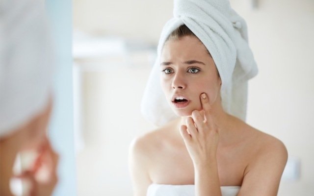 Botanix Pharma’s acne product effects antibiotic-resistant acne