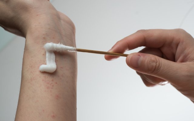 Botanix Pharmaceuticals receives strong results amid growing dermatitis rates