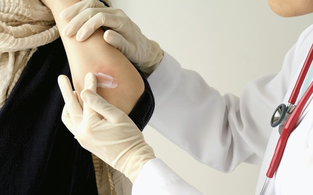 Botanix study finds CBD has anti-inflammatory and immune modulating effects on skin disease