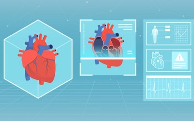 Cashed up Echo IQ tackles the US heart disease market with AI-based diagnostic technology