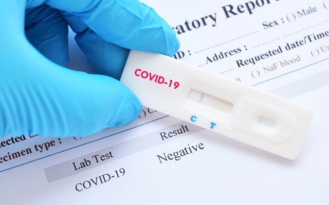 Cellmid set to commercialise 15 minute diagnostic test for COVID-19