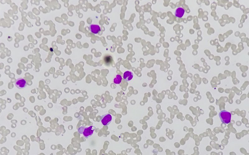 Chimeric Therapeutics to supply CHM 0201 for cell study into treatments for acute myeloid leukaemia