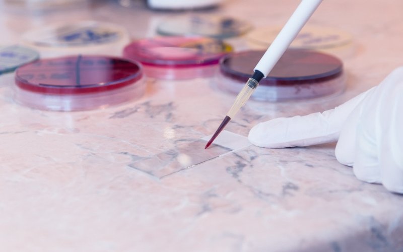 Chimeric Therapeutics’ CHM 0201 and standard care drugs to transform AML treatment in new clinical study