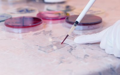 Chimeric Therapeutics’ CHM 0201 and standard care drugs to transform AML treatment in new clinical study