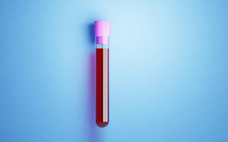 Cleo Diagnostics IPO raises $12 million to develop early-stage detection blood test for ovarian cancer