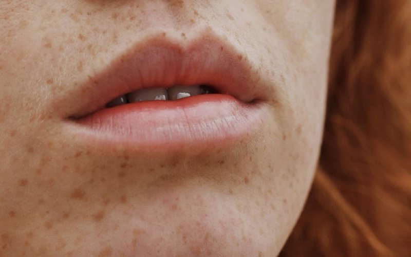 Clinuvel reports breakthrough against UV damage in skin DNA repair study using afamelanotide