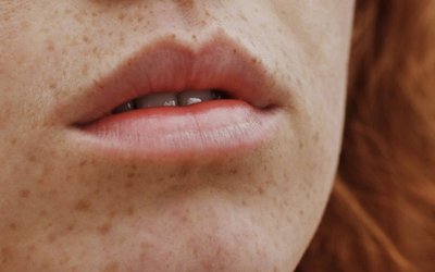 Clinuvel reports breakthrough against UV damage in skin DNA repair study using afamelanotide