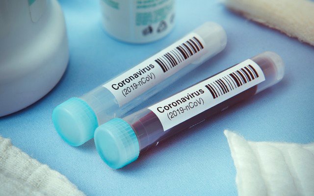 Coronavirus outbreak shakes up ASX share market