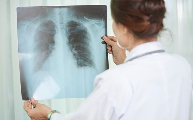 Coronavirus prompts more orders for Micro-X’s mobile x-ray units