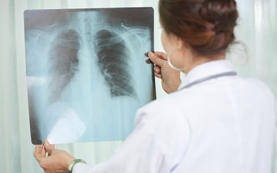 Coronavirus prompts more orders for Micro-X’s mobile x-ray units