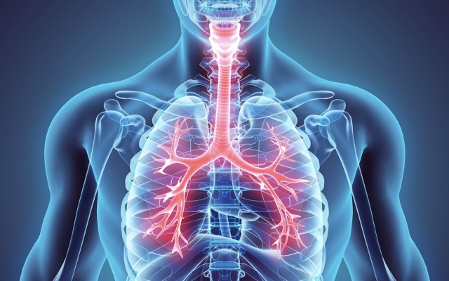 Cyclopharm set to take the fight against asthma to the next level via Technegas