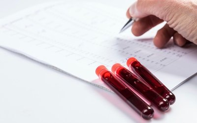 Cynata Therapeutics has positive pre-clinical results using Cymerus stem cell platform to treat sepsis