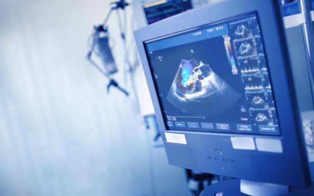 Echo IQ raises $3.27m to fast-track US expansion of AI-based cardiovascular diagnostic technology