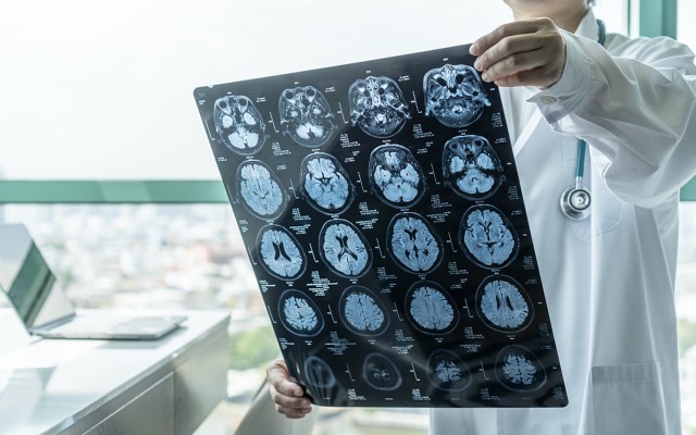 EMVision awarded $8m to develop first responder portable brain scanner for stroke patients