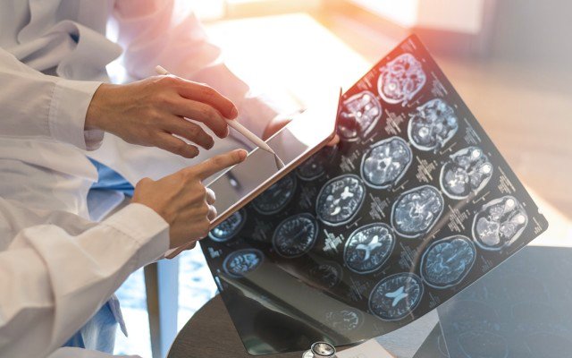 EMVision enhances portable brain scanner with new techniques to improve diagnosis and care of stroke patients