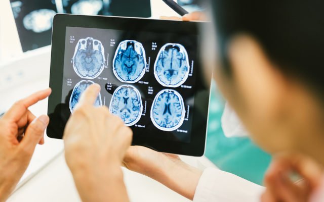 Enhanced brain cancer survival rates shown in Patrys’ pre-clinical trials