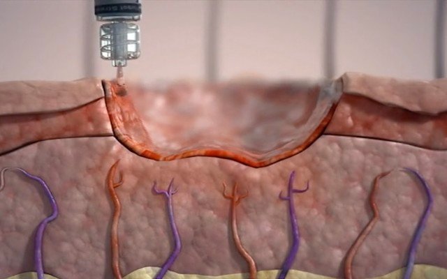 Factor Therapeutics halts development of VF001 after failed drug trial, company restructures