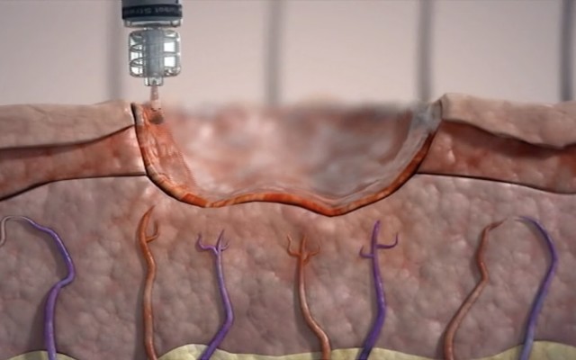 Factor Therapeutics halts development of VF001 after failed drug trial, company restructures