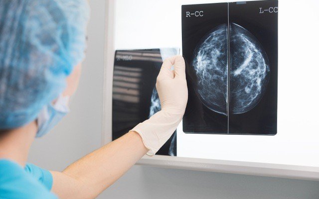 Genetic Technologies works with University of Melbourne to expand breast cancer test to women with hereditary risk