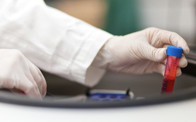 Imugene completes recruitment for HER-Vaxx clinical trials