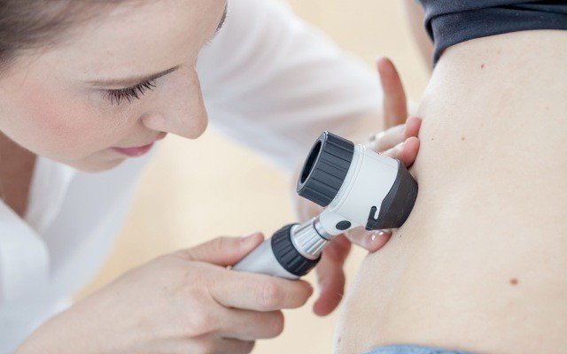 Imugene makes inroads into melanoma resistance via arginine drug candidate