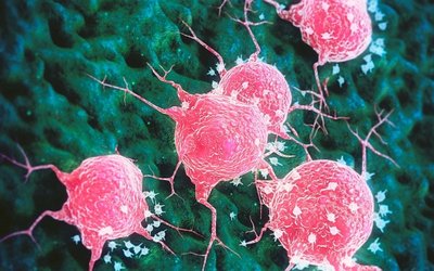 Imugene’s novel cancer treatment enters new phase in MAST trial