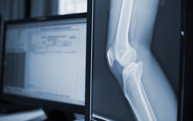 International symposium sets scene for Paradigm Biopharmaceuticals’ MPS trial