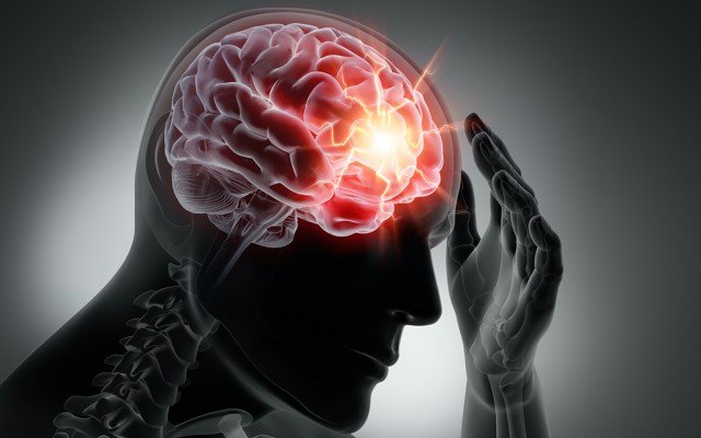 Invex Therapeutics closes busy quarter of development on Presendin for idiopathic intracranial hypertension