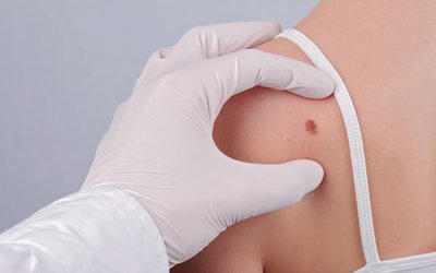 Invion advances skin cancer treatment with positive safety data for INV043 in Phase I/II trial