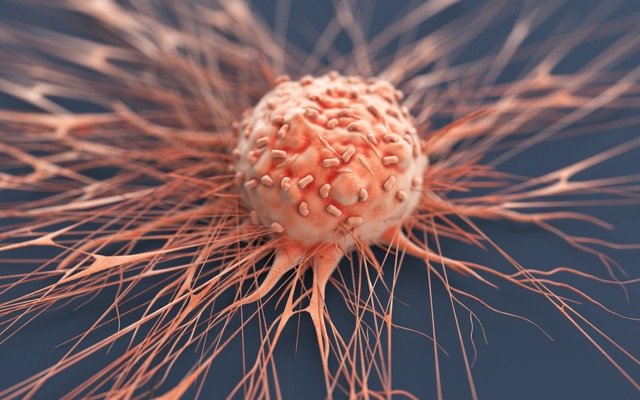 Kazia Therapeutics expands paxalisib study to include secondary brain tumours from breast cancer