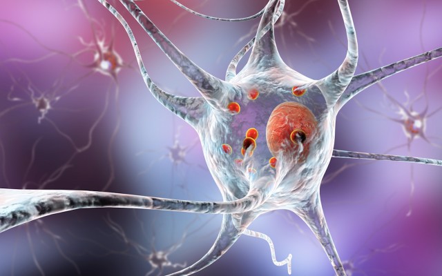 Living Cell Technologies publishes encouraging follow up data for Parkinson’s drug NTCELL