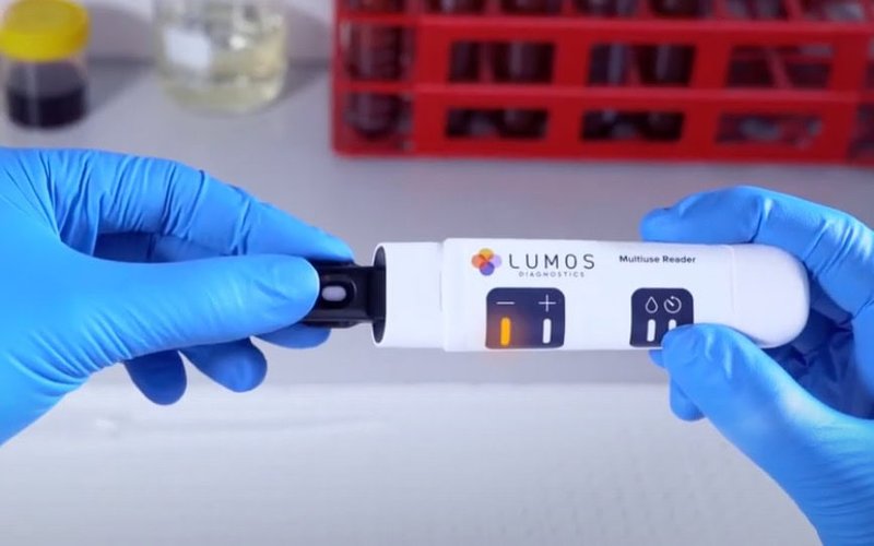 Lumos Diagnostics secures additional US$5m for pioneering pre-term birth test development