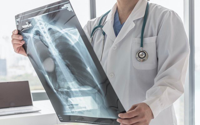 Mesoblast’s remestemcel-L receives FDA IND clearance for treating COVID-19 patients with acute respiratory distress