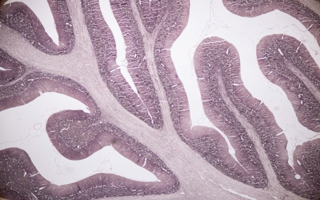 Orthocell’s latest pre-clinical study underlines CelGro performance in nerve repair