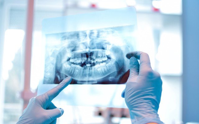 Orthocell looks to enter US market following positive CelGro study results