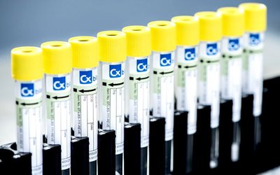 Pacific Edge’s Cxbladder Triage biomarker test recognised as standard of care in AUA guideline update