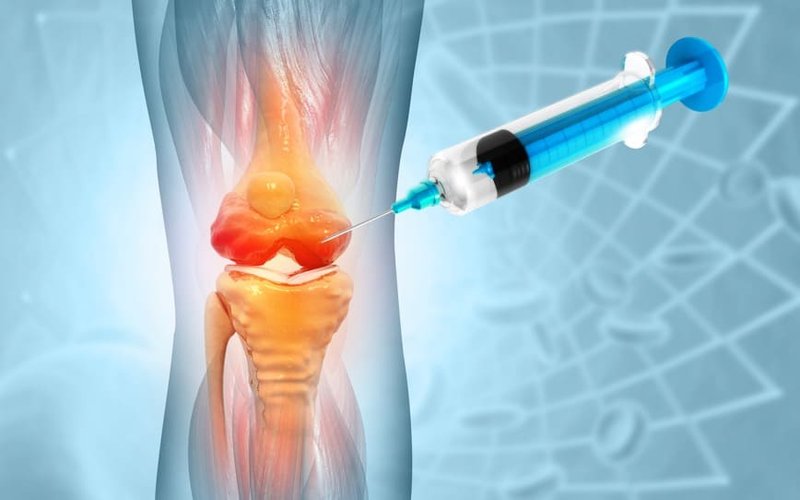 Paradigm’s iPPS shown to reduce cartilage loss and improve function in osteoarthritis patients