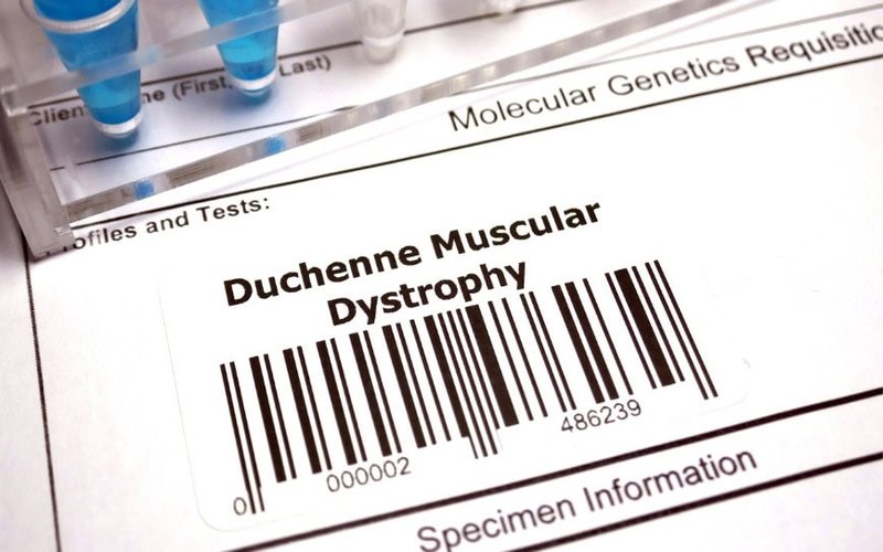 Percheron Therapeutics completes toxicology study for avicursen ahead of US FDA discussions