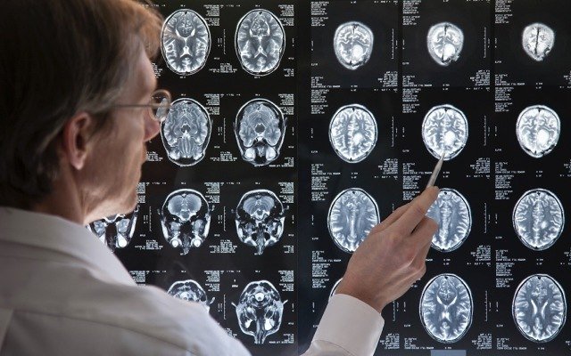 Pre-clinical data suggests Noxopharm’s anti-cancer drug can boost radiation effect on paediatric brain cancer