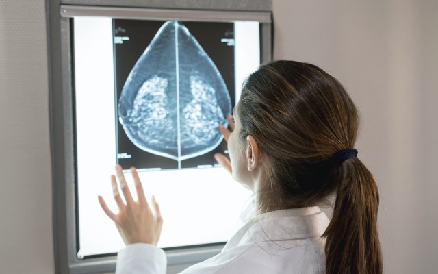 Prescient Therapeutics receives encouraging efficacy results for leading cancer drug candidate PTX-200