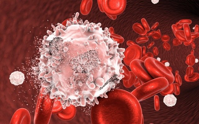 Race Oncology looks to rediscover effective leukaemia drug
