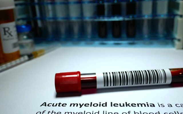 Race Oncology confirms positive results from Bisantrene drug trial on patients with advanced acute myeloid leukaemia