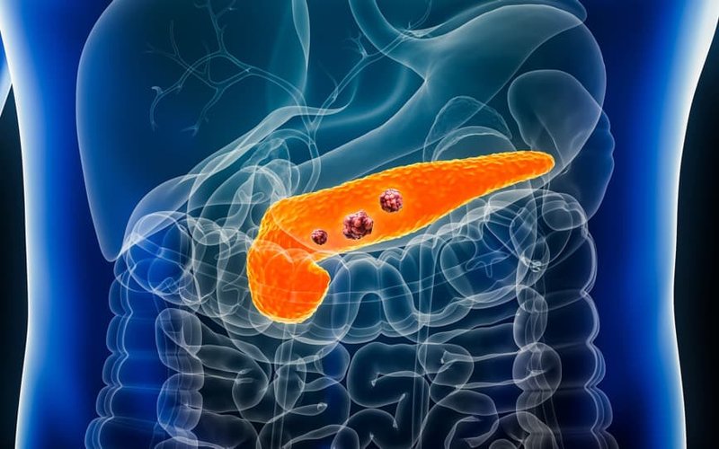 Radiopharm Theranostics’ pancreatic cancer drug secures FDA nod for Phase 1 trial