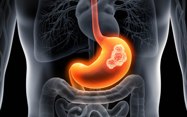 Researchers to study Imugene’s cancer therapy following US Department of Defense grant