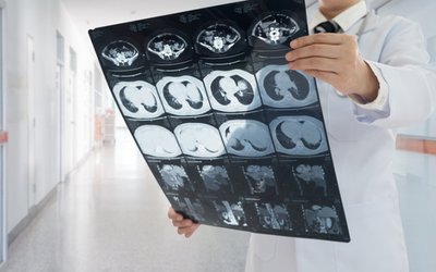 Resonance Health’s FerriSmart MRI iron detection technology to be marketed in US